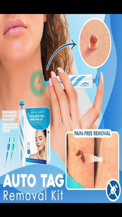 Kit Eliminador de Verrugas – Cuida tu piel desde casa ✨